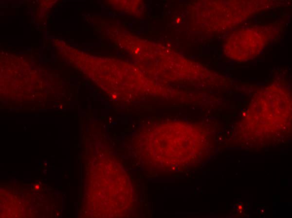 c-Abl(Phospho-Tyr412)