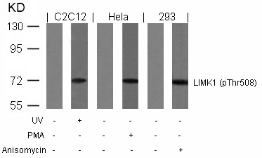 LIMK1(Phospho-Thr508)
