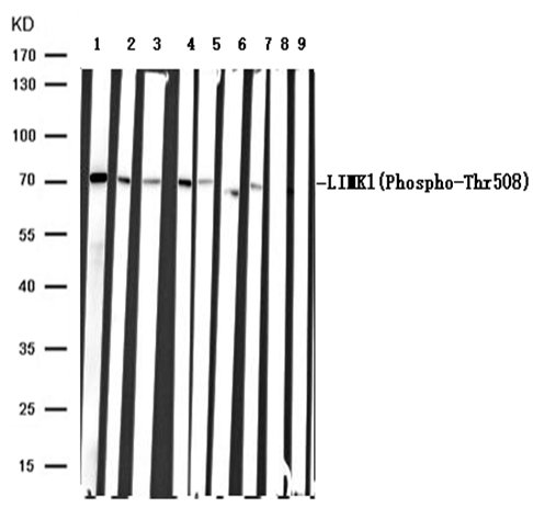 Rabbit Polyclonal Antibody to LIMK1(Phospho-Thr508)