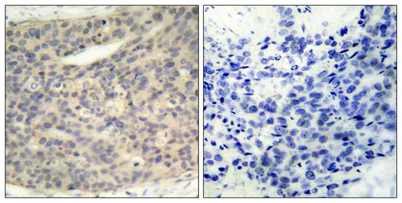 Rabbit Polyclonal Antibody to LIMK1(Phospho-Thr508)