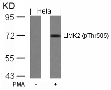 LIMK2(Phospho-Thr505)