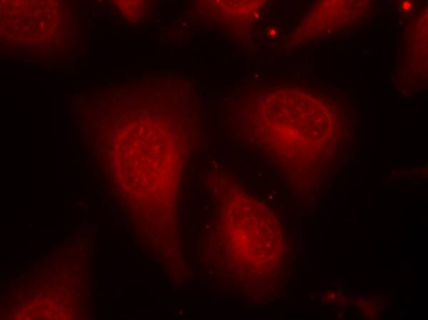 HDAC8(Phospho-Ser39)