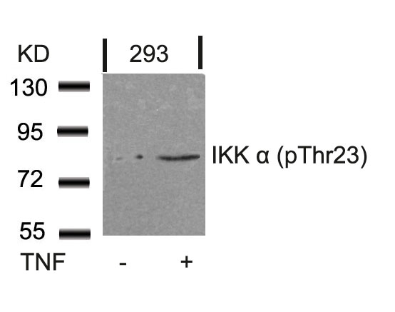 IKK a(Phospho-Thr23)