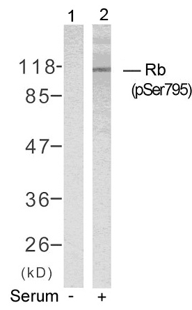 Rb(Phospho-Ser795)