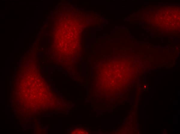 Rabbit Polyclonal Antibody to Rb(Phospho-Ser795)