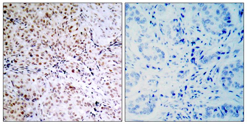 Rabbit Polyclonal Antibody to Rb(Phospho-Ser795)