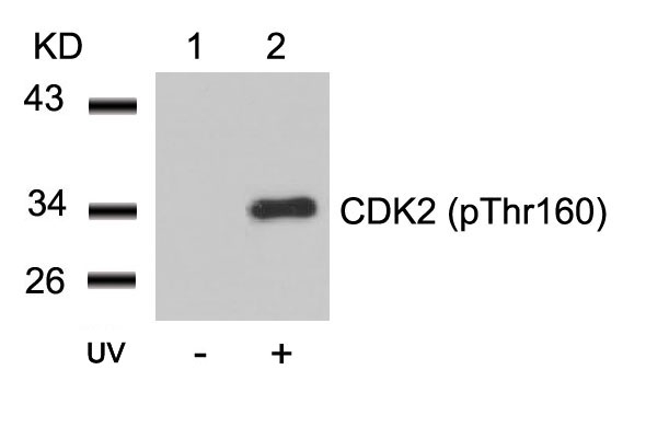 CDK2(Phospho-Thr160)