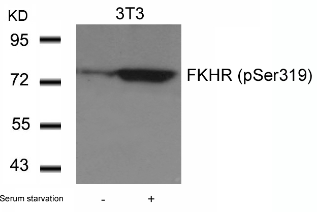 FKHR(Phospho-Ser319)