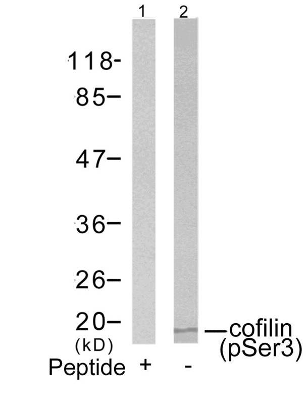 cofilin(Phospho-Ser3)