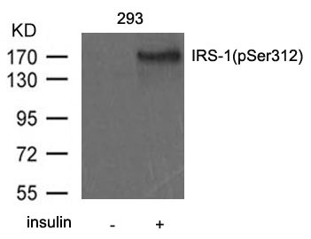 IRS-1(Phospho-Ser312)