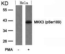 MKK3(Phospho-Ser189)
