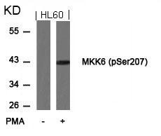 MKK6(Phospho-Ser207)