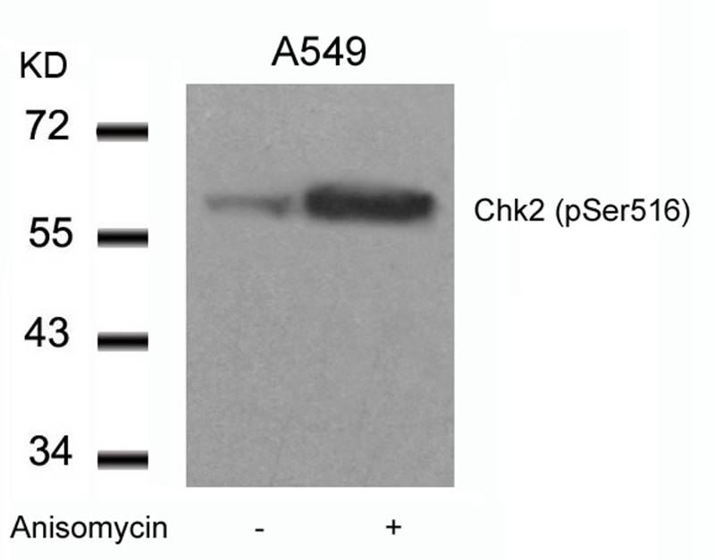 Chk2(Phospho-Ser516)