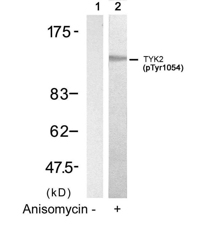 TYK2(Phospho-Tyr1054)