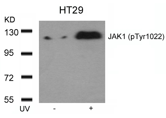 JAK1(Phospho-Tyr1022)