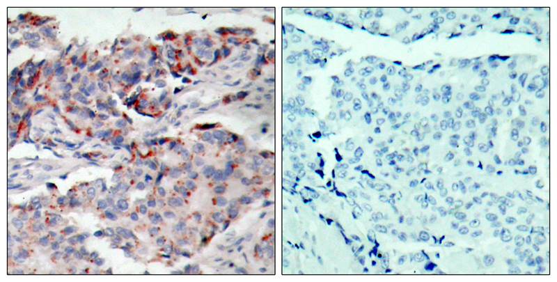 JAK2(Phospho-Tyr221)