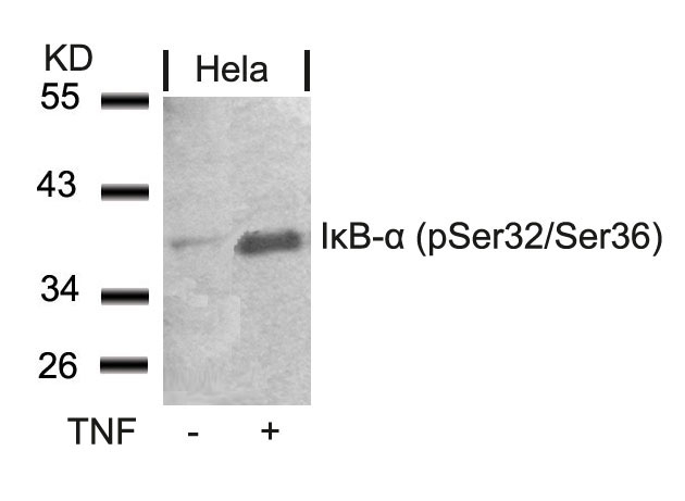 IkB-a(Phospho-Ser32/Ser36)