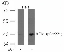 MEK1(Phospho-Ser221)