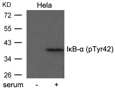 IkB-a(Phospho-Tyr42) 
