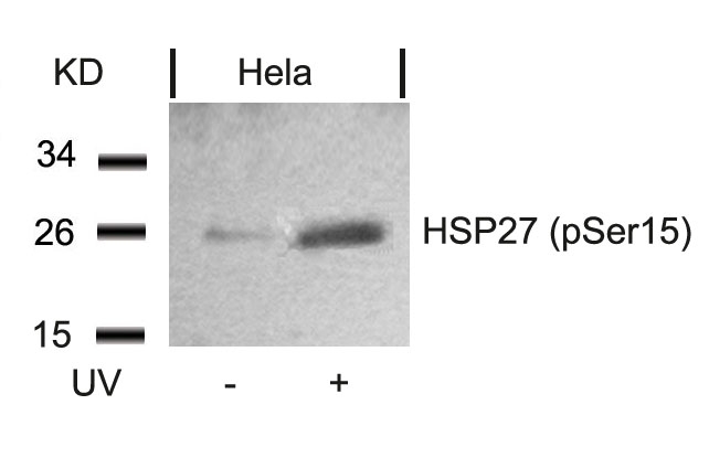 HSP27(Phospho-Ser15)