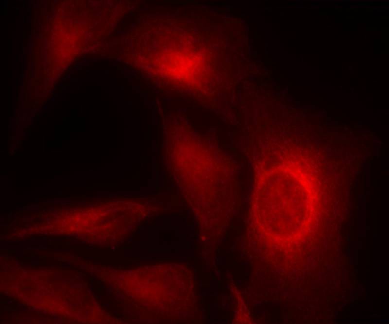 Rabbit Polyclonal Antibody to HSP27(Phospho-Ser15)