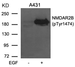 NMDAR2B(phospho-Tyr1474)
