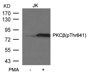 PKCb(Phospho-Thr641)