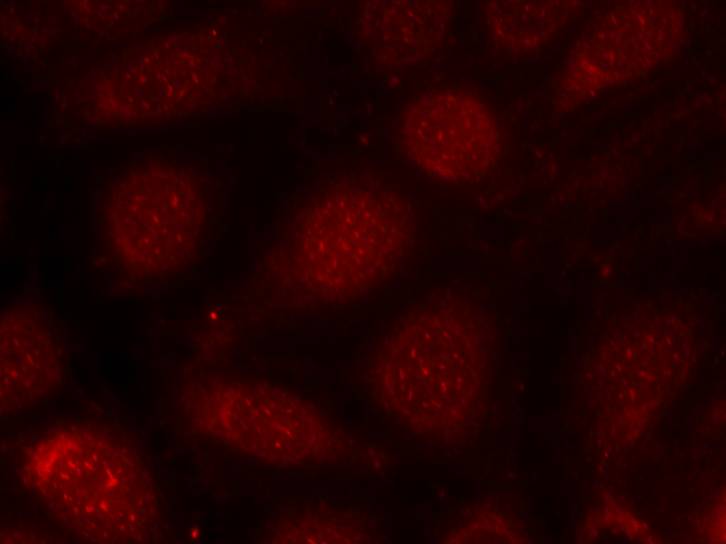 Rabbit Polyclonal Antibody to PKCb(Phospho-Thr641)