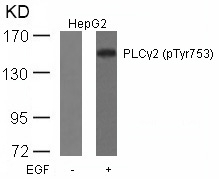 PLCg2(Phospho-Tyr753)