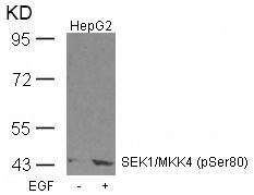 SEK1/MKK4(Phospho-Ser80)