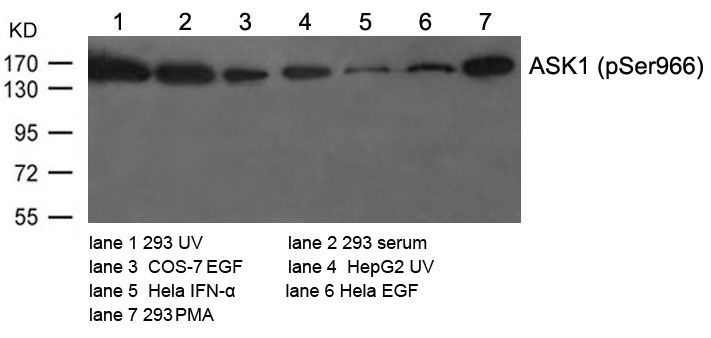 ASK1(Phospho-Ser966)