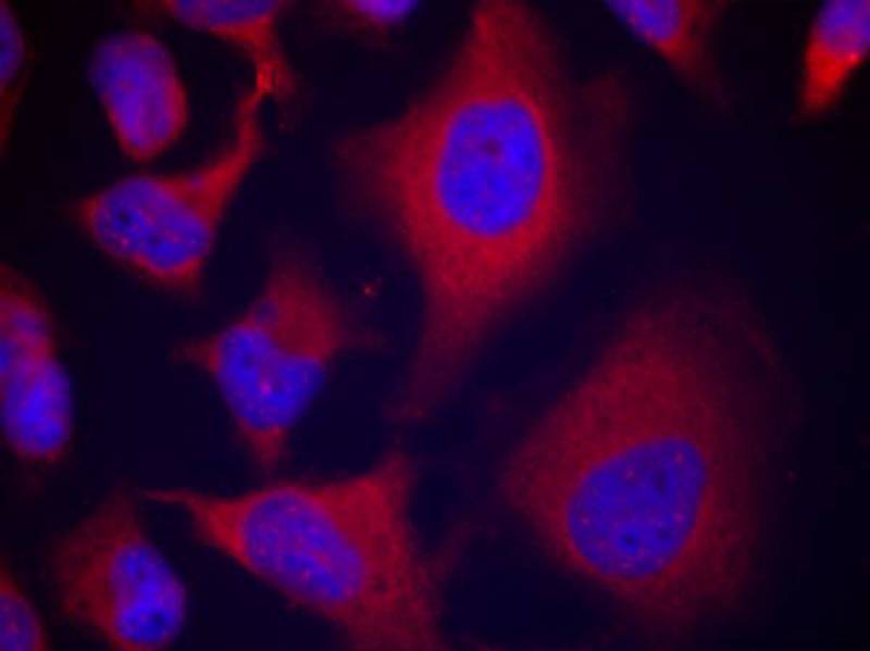 Rabbit Polyclonal Antibody to ADD1(Phospho-Ser726)