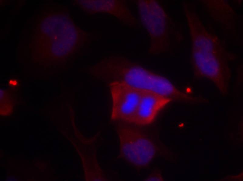 DARPP-32(Phospho-Thr75)