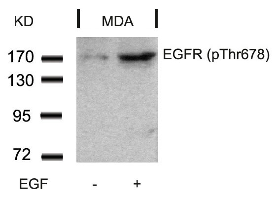 EGFR(Phospho-Thr678)