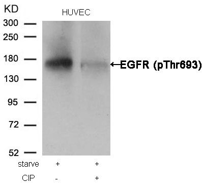 Rabbit Polyclonal Antibody to EGFR(Phospho-Thr693)
