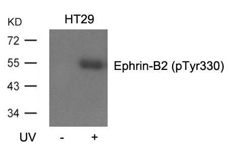 Ephrin-B2(Phospho-Tyr330)