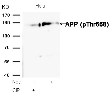 Rabbit Polyclonal Antibody to APP(Phospho-Thr668)