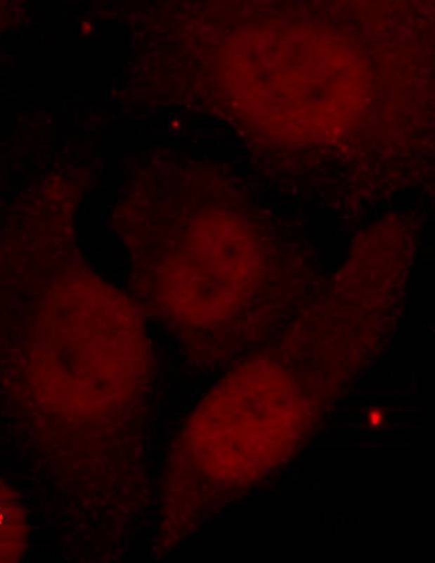Rabbit Polyclonal Antibody to HDAC2(Phospho-Ser394)