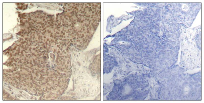 Rabbit Polyclonal Antibody to HDAC2(Phospho-Ser394)