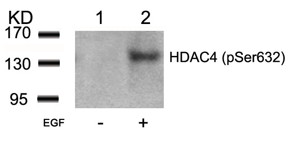 HDAC4(Phospho-Ser632)