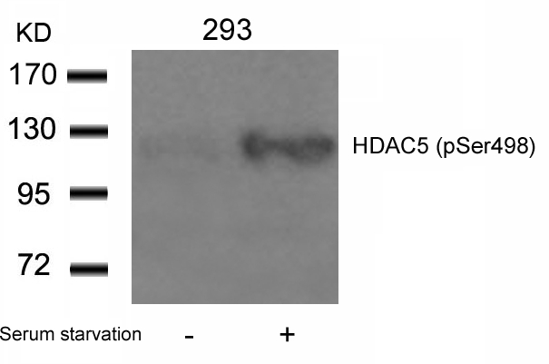 HDAC5(Phospho-Ser498)