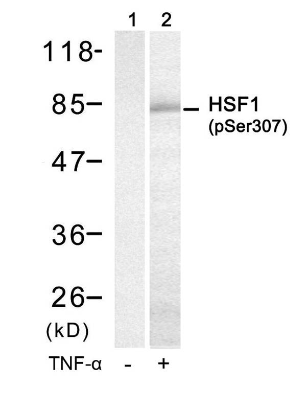 HSF1(Phospho-Ser307)