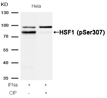 Rabbit Polyclonal Antibody to HSF1(Phospho-Ser307)
