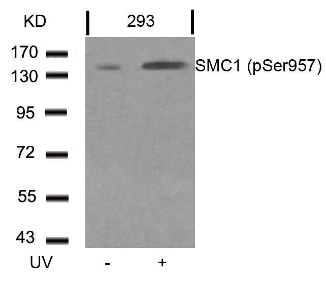 SMC1(Phospho-Ser957)