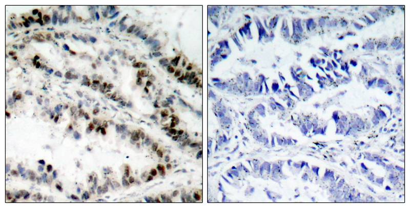 Rabbit Polyclonal Antibody to SMC1(Phospho-Ser957)