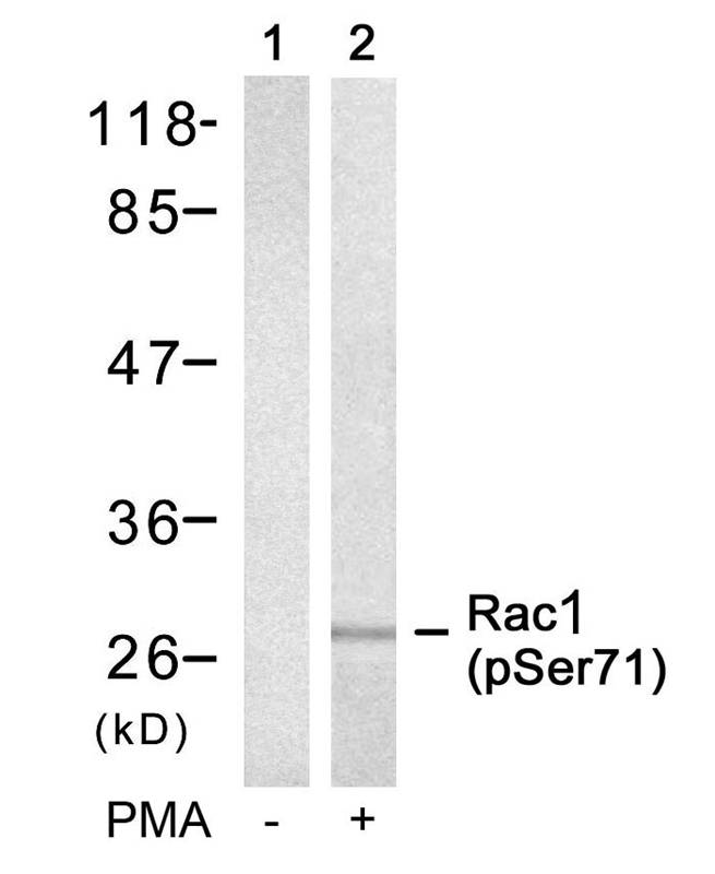 Rac1(Phospho-Ser71)