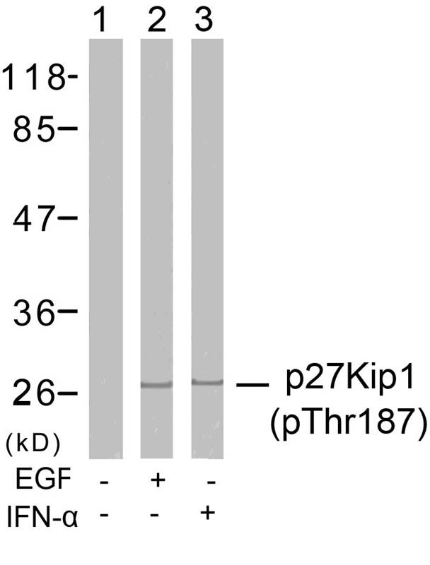 p27Kip1(Phospho-Thr187)