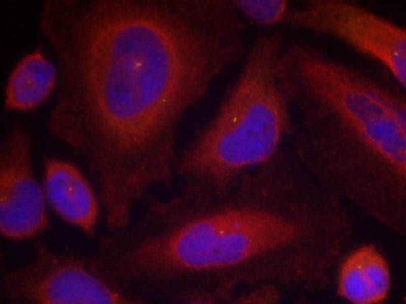 Synaptotagmin 1 (Phospho-Ser309)