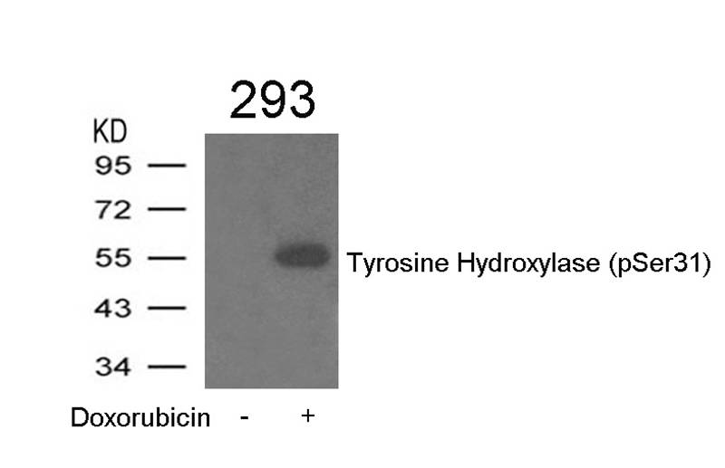 Tyrosine Hydroxylase(Phospho-Ser31)