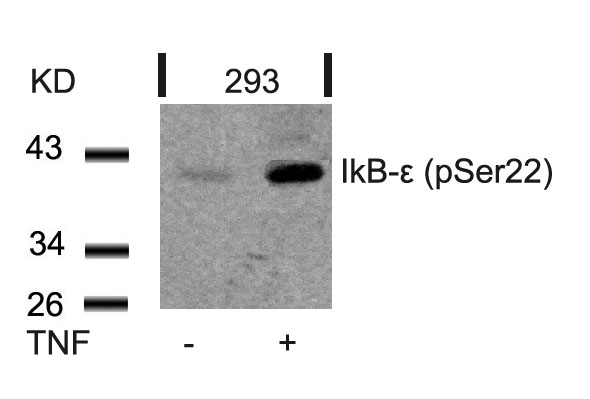 IkB-e(Phospho-Ser22)